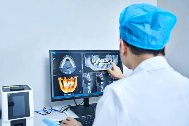 Best Emergency Wisdom Teeth Removal in Westlake Village, CA